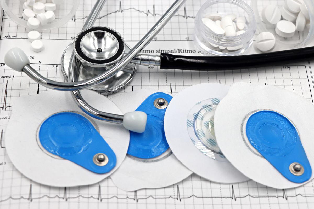 Cardiology instruments including a stethoscope and ECG electrodes on a clinical chart
