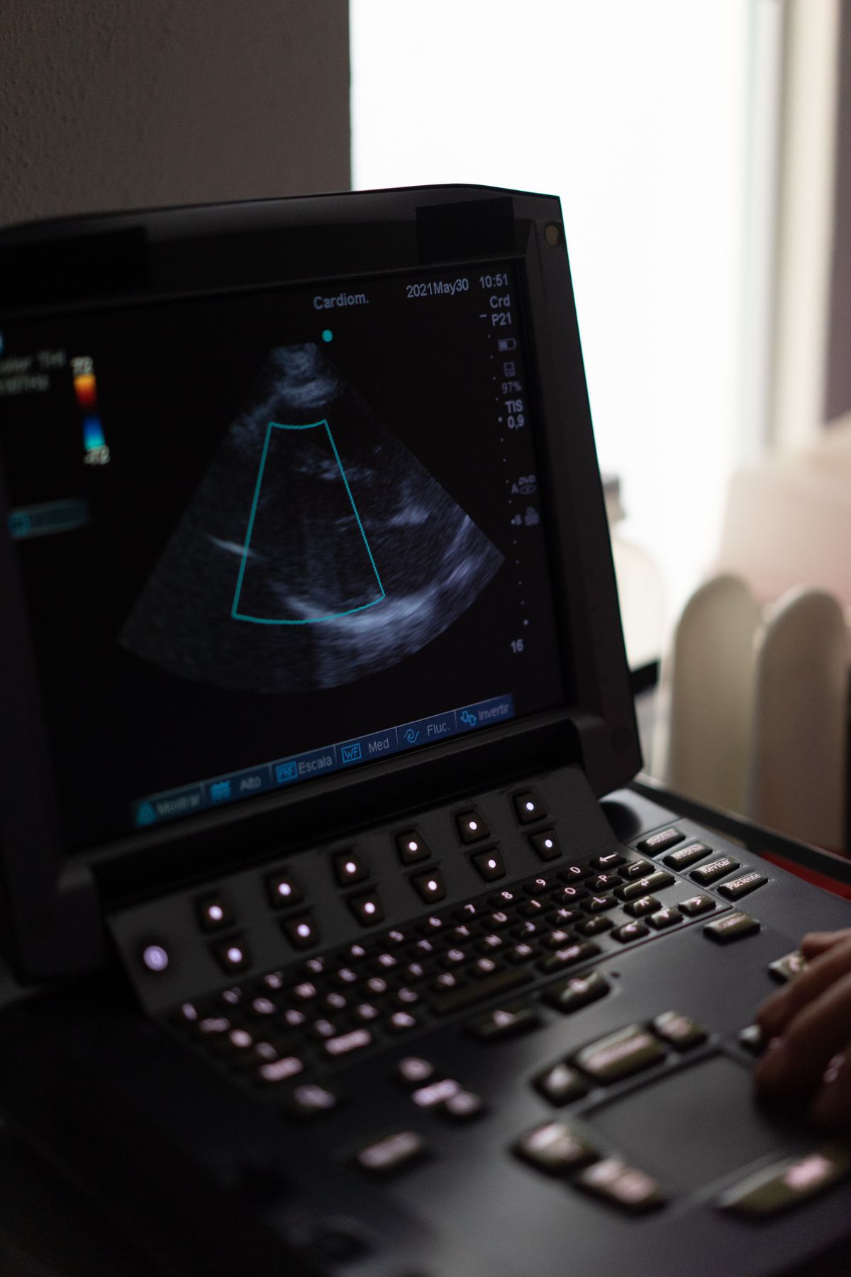 Close-up of an ultrasound machine screen displaying a cardiac image